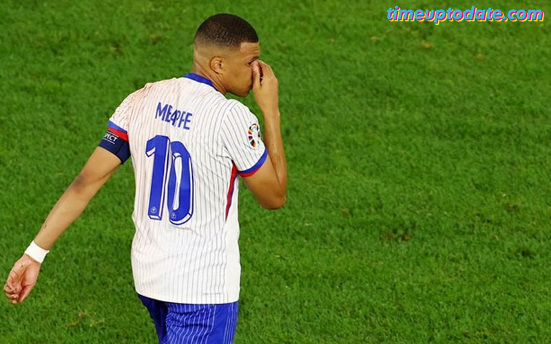 Hidungnya Patah, Mbappe Cari Topeng